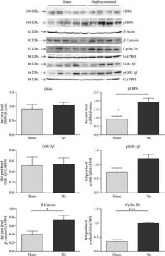 Monoclonal Anti-Cyclin D1 antibody produced in mouse clone DCS-6, ascites fluid