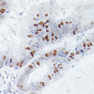 Anti-RBPJK antibody produced in rabbit