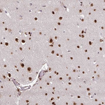 Anti-U2AF1 antibody produced in rabbit Prestige Antibodies&#174; Powered by Atlas Antibodies, affinity isolated antibody, buffered aqueous glycerol solution