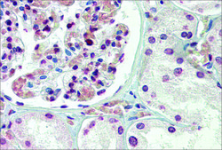 Anti-TBX20 (AB1) antibody produced in rabbit affinity isolated antibody