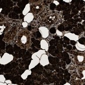 Anti-PHLDA1 antibody produced in rabbit Prestige Antibodies® Powered by Atlas Antibodies, affinity isolated antibody, buffered aqueous glycerol solution