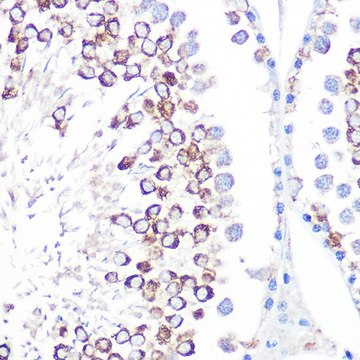 Anti-CD59 antibody produced in rabbit