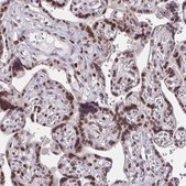 Anti-RB1 antibody produced in rabbit Prestige Antibodies® Powered by Atlas Antibodies, affinity isolated antibody, buffered aqueous glycerol solution