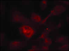 Anti-PAK1/PAK2/PAK3 (Ab-423/402/421) antibody produced in rabbit affinity isolated antibody