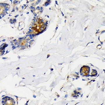 Anti-Mammaglobin A antibody produced in rabbit