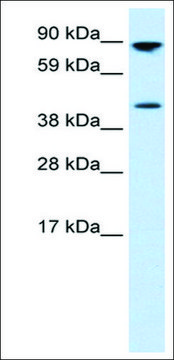 Anti-ETV4 antibody produced in rabbit affinity isolated antibody