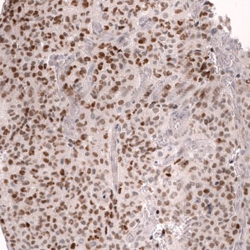 Monoclonal Anti-Foxo3 Antibody Produced In Mouse Prestige Antibodies&#174; Powered by Atlas Antibodies, clone CL13589, affinity isolated antibody, buffered aqueous glycerol solution