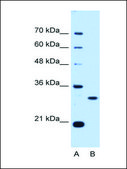 Anti-PSME3 (AB1) antibody produced in rabbit affinity isolated antibody