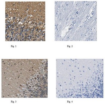 Anti-Histone-lysine N-methyltransferase NSD3 Antibody from rabbit, purified by affinity chromatography