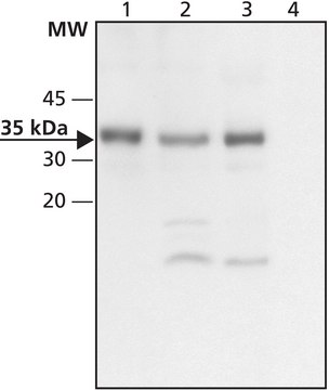 Anti-CHIP (C-terminal) 兔抗 ~1&#160;mg/mL, affinity isolated antibody, buffered aqueous solution