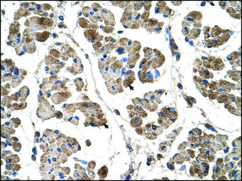 Anti-ACTN2 (AB2) antibody produced in rabbit IgG fraction of antiserum