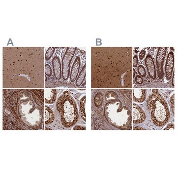 Anti-NAE1 antibody produced in rabbit Prestige Antibodies&#174; Powered by Atlas Antibodies, affinity isolated antibody, buffered aqueous glycerol solution