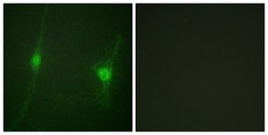 Anti-LKB1, C-Terminal antibody produced in rabbit affinity isolated antibody