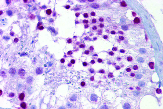 Anti-PITX3 antibody produced in rabbit affinity isolated antibody