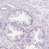 Anti-SMYD1 antibody produced in rabbit Prestige Antibodies® Powered by Atlas Antibodies, affinity isolated antibody, buffered aqueous glycerol solution