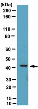 Anti-Endophilin-A1 Antibody from rabbit, purified by affinity chromatography