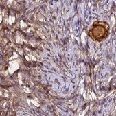 Anti-ST13 antibody produced in rabbit Prestige Antibodies® Powered by Atlas Antibodies, affinity isolated antibody, buffered aqueous glycerol solution