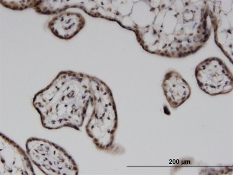 Monoclonal Anti-ILKAP, (C-terminal) antibody produced in mouse clone 3B5, purified immunoglobulin, buffered aqueous solution