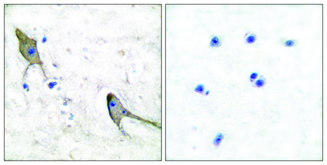 Anti-PYK2 antibody produced in rabbit affinity isolated antibody