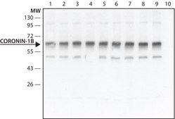 Anti-Coronin 1B antibody produced in rabbit ~1.5 mg/mL, affinity isolated antibody
