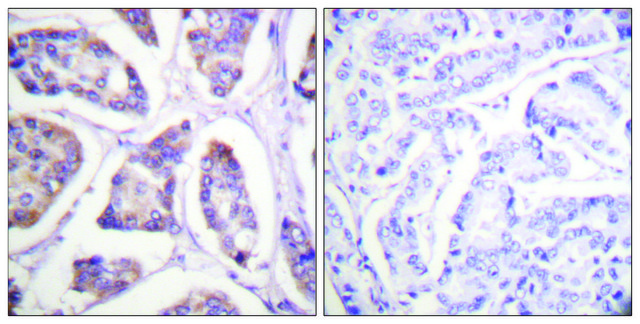 抗-黏着斑蛋白 兔抗 affinity isolated antibody