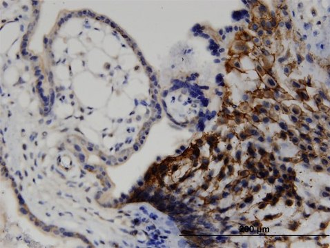 Monoclonal Anti-LIMA1, (N-terminal) antibody produced in mouse clone 1B7, purified immunoglobulin, buffered aqueous solution