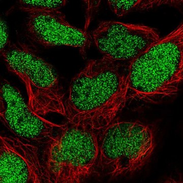 Anti-TM2D1 antibody produced in rabbit Prestige Antibodies&#174; Powered by Atlas Antibodies, affinity isolated antibody