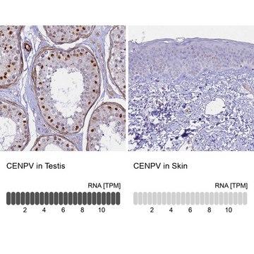 Anti-CENPV antibody produced in rabbit affinity isolated antibody, buffered aqueous glycerol solution