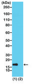 Anti-Acetyl-Histone H3 (Lys56) antibody, Rabbit monoclonal recombinant, expressed in HEK 293 cells, clone RM179, purified immunoglobulin