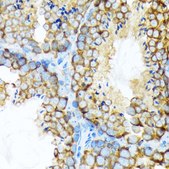 Anti-STIP1 antibody produced in rabbit
