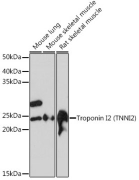 Anti-Troponin I2 (TNNI2) Antibody, clone 2H7S10, Rabbit Monoclonal