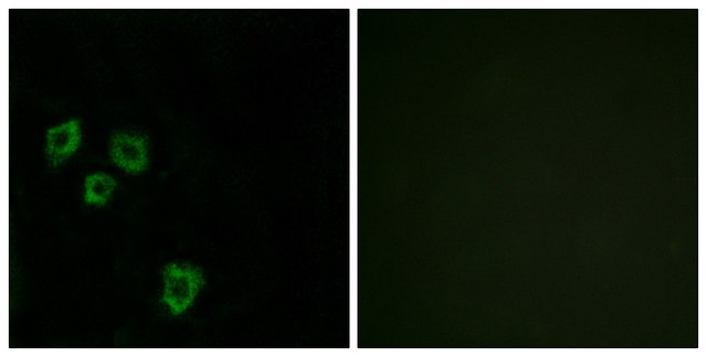 Anti-MUC16 antibody produced in rabbit affinity isolated antibody