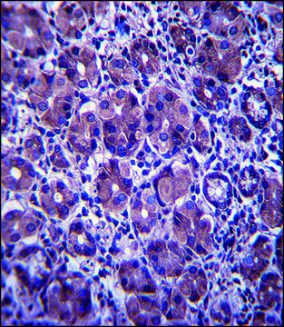 ANTI-ANKRD22 (C-TERM) antibody produced in rabbit IgG fraction of antiserum, buffered aqueous solution