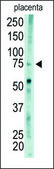 Anti-UBA2 (C-term A600) antibody produced in rabbit IgG fraction of antiserum, buffered aqueous solution