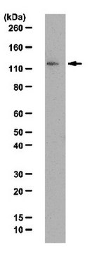 Anti-JMJD1A Antibody from rabbit, purified by affinity chromatography