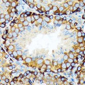 Anti-KAT9/Elp3 antibody produced in rabbit