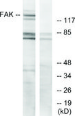 Anti-FAK antibody produced in rabbit affinity isolated antibody