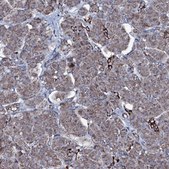 Anti-MRPS35 antibody produced in rabbit Prestige Antibodies® Powered by Atlas Antibodies, affinity isolated antibody, buffered aqueous glycerol solution
