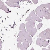 Anti-SLC25A24 antibody produced in rabbit Prestige Antibodies® Powered by Atlas Antibodies, affinity isolated antibody