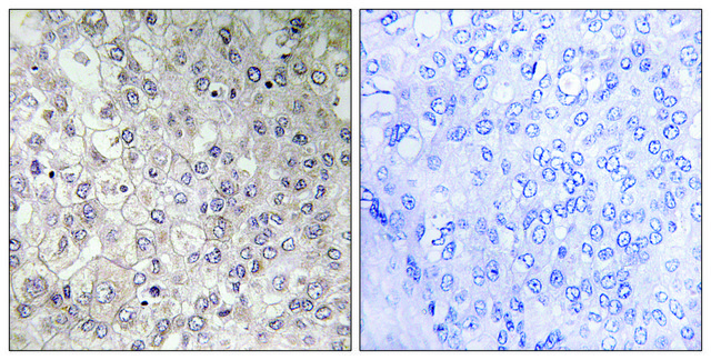 Anti-GIPR antibody produced in rabbit affinity isolated antibody