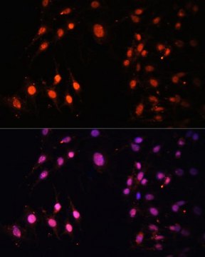 Anti-SETD2 antibody produced in rabbit