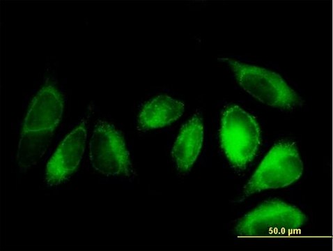 Anti-ALDH3A2 antibody produced in mouse purified immunoglobulin, buffered aqueous solution