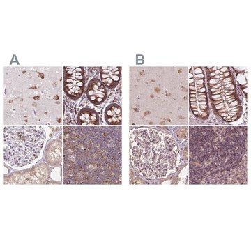 Anti-RPS5 antibody produced in rabbit Prestige Antibodies&#174; Powered by Atlas Antibodies, affinity isolated antibody, buffered aqueous glycerol solution