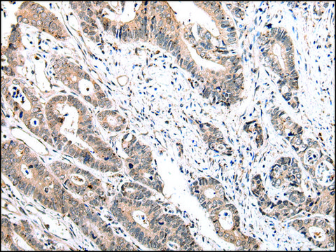 Anti-IL15 affinity isolated antibody