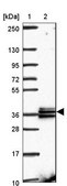 Anti-RDH14 antibody produced in rabbit Prestige Antibodies® Powered by Atlas Antibodies, affinity isolated antibody, buffered aqueous glycerol solution