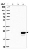 Anti-APOM antibody produced in rabbit Prestige Antibodies® Powered by Atlas Antibodies, affinity isolated antibody, buffered aqueous glycerol solution