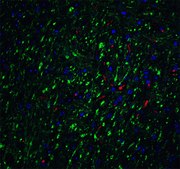 Anti-LMX1B antibody produced in rabbit affinity isolated antibody