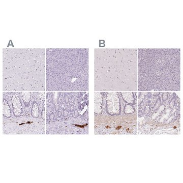 Anti-PRPH antibody produced in rabbit Prestige Antibodies&#174; Powered by Atlas Antibodies, affinity isolated antibody, buffered aqueous glycerol solution