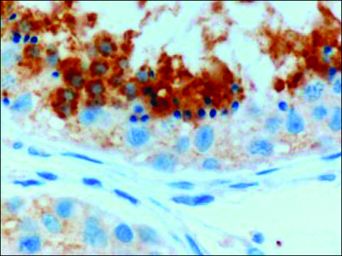 Anti-GPX4 (Isoform A and C) antibody produced in goat affinity isolated antibody, buffered aqueous solution