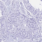 Anti-CGB3 antibody produced in rabbit Prestige Antibodies® Powered by Atlas Antibodies, affinity isolated antibody, buffered aqueous glycerol solution